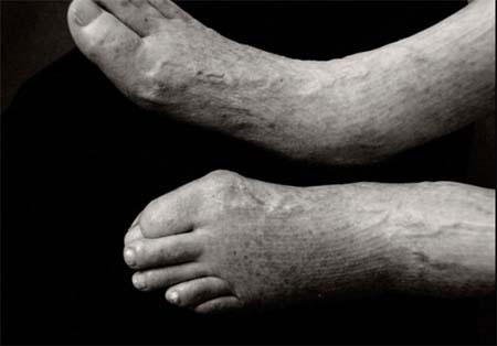 بدن انسان در 100 سالگی (+عکس)