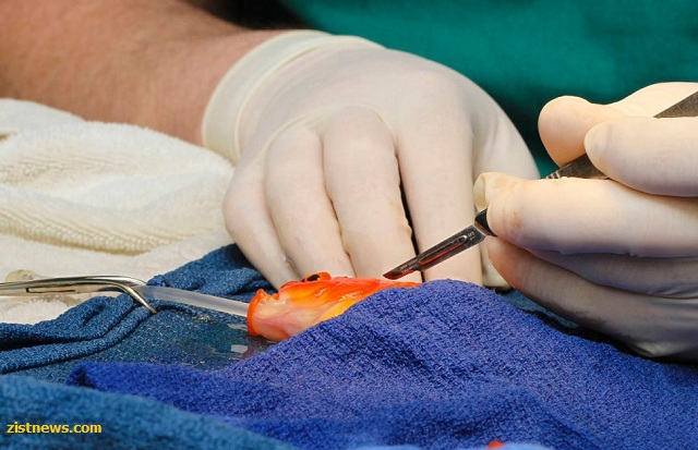 جراحی مغز متفاوت!