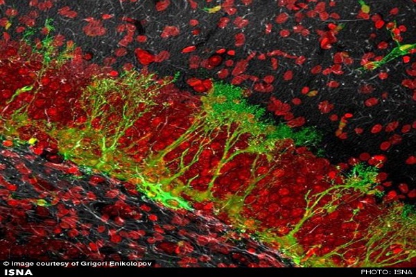 خشم چگونه ساختار مغز را تغییر میدهد؟ خشم چگونه ساختار مغز را تغییر میدهد؟