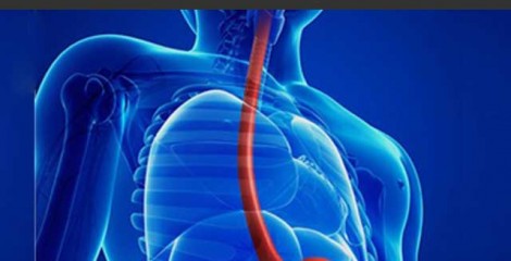 بازسازی بافت آسیبدیده مری بازسازی بافت آسیبدیده مری