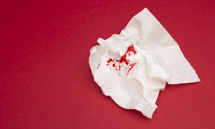 لخته خون و 7 دلیل وجود آن در مدفوع لخته خون و 7 دلیل وجود آن در مدفوع