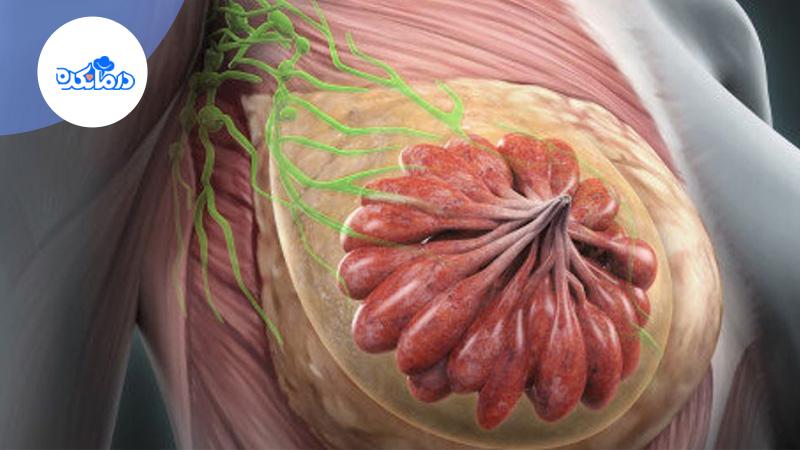 ماستیت چیست؟ آشنایی با علائم، علت و درمان بیماری