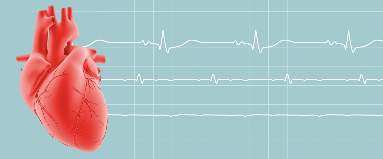 لرزش عصبی قفسه سینه یا تپش قلب؛ علل، شباهت و تفاوت ها لرزش عصبی قفسه سینه یا تپش قلب؛ علل، شباهت و تفاوت ها